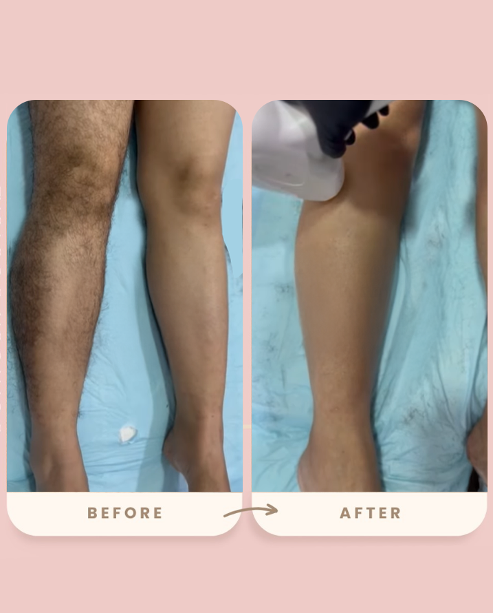 Legs Result 1
