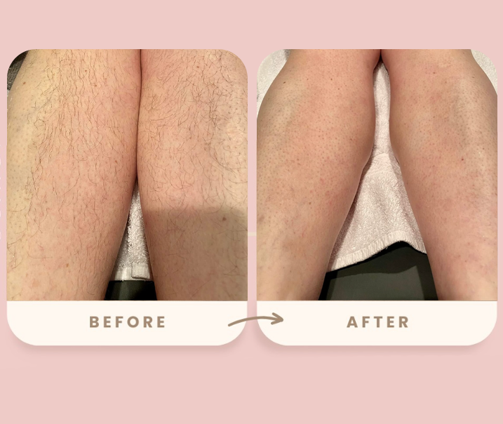 Legs Result 2